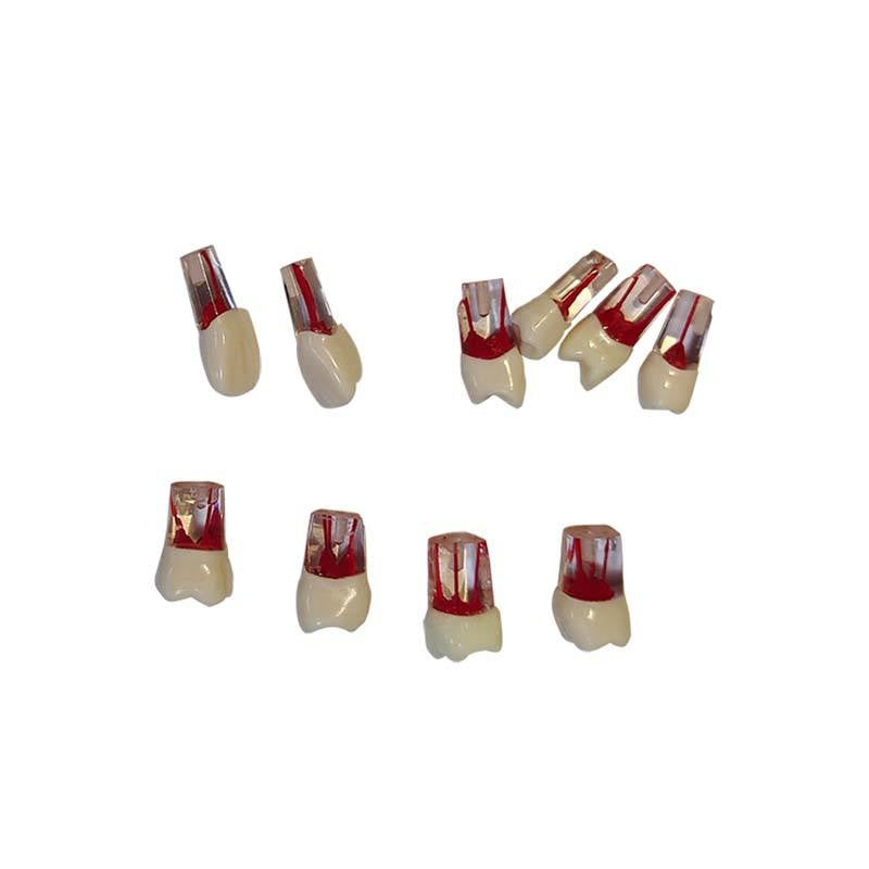 Replaceable Spare Tooth Model Accessories Dental Teaching Aids Replace Teeth for CL-L1
