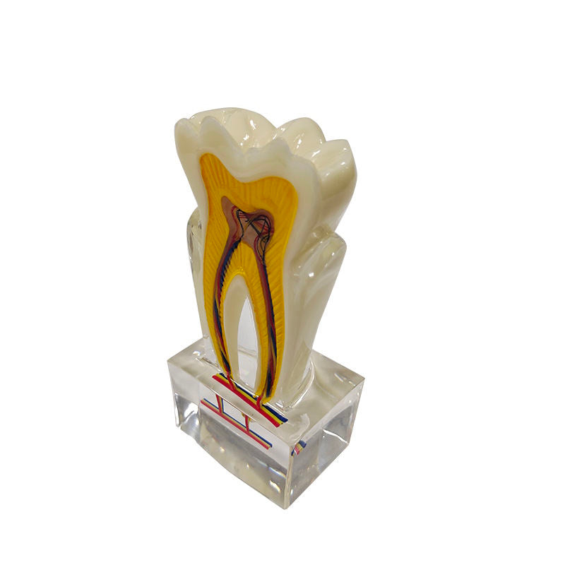 Sectioned 6 Times Molar Dental Tooth Model with Nerve