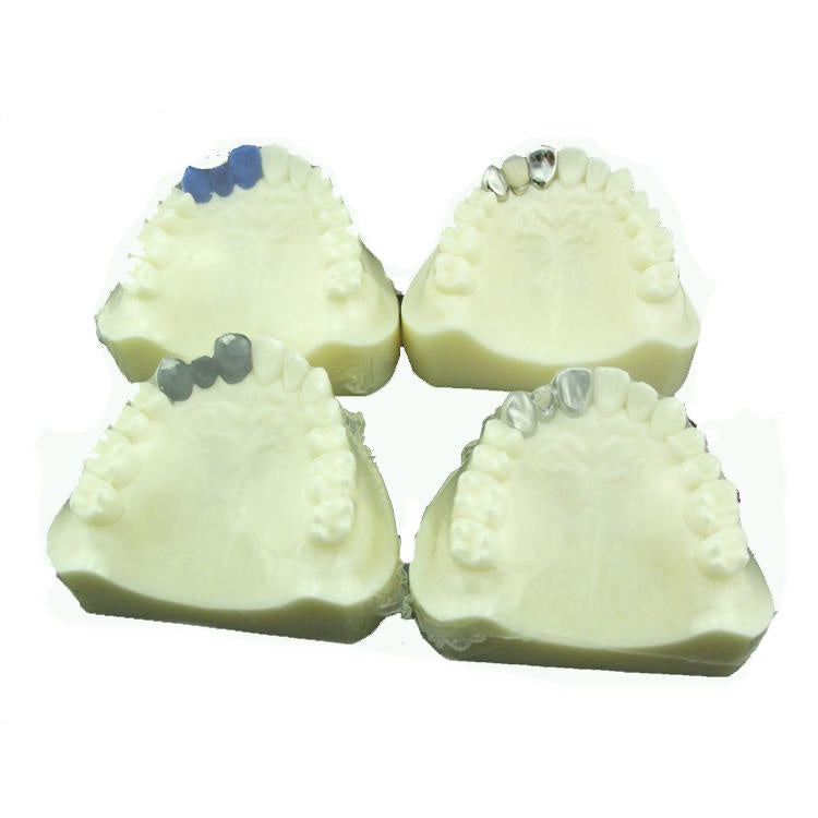 Dental Model Producing Steps of Marilan Bridge