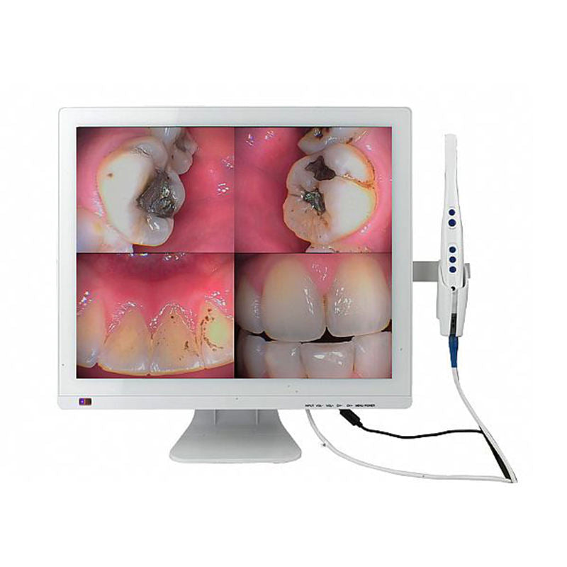 Dental Camera Intra Oral Video Recording Dental Intraoral Endoscopy