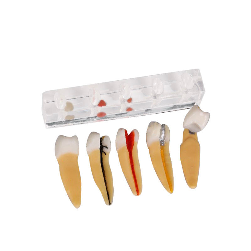 5 Stages Demonstration Model for Endodontic Treatment