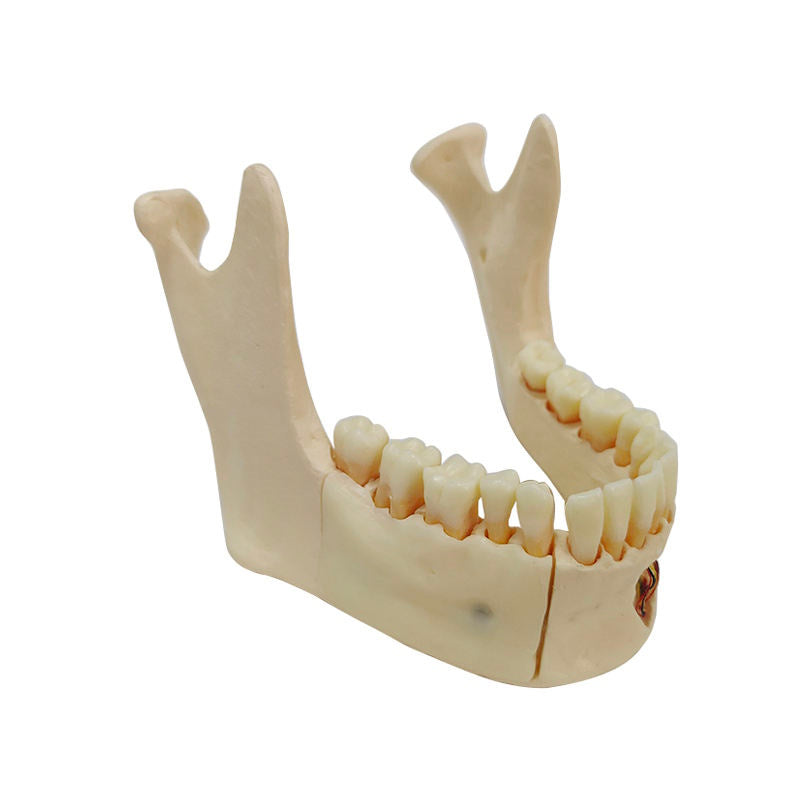 Educational Model Nature Size Mandible with Hinge Buccal Plate