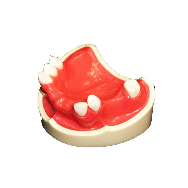 21pcs Teeth Missing Dental Model for Students Practice