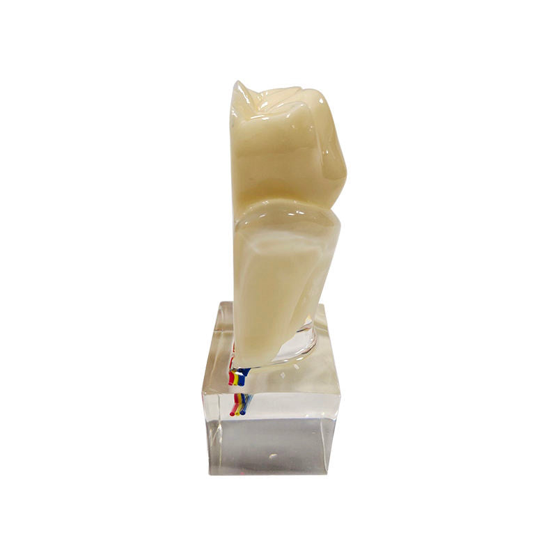 Sectioned 6 Times Molar Dental Tooth Model with Nerve