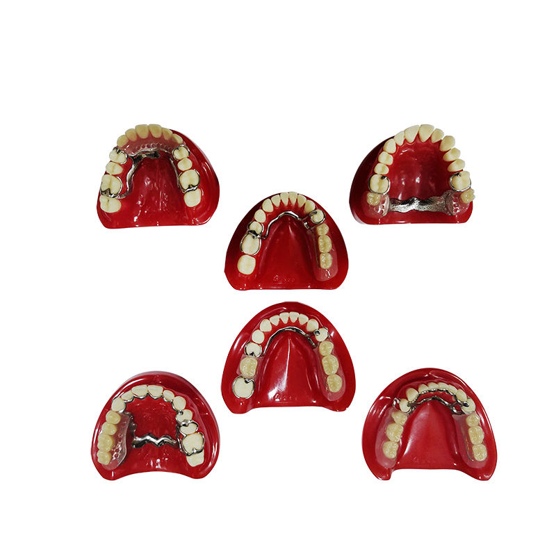 Import Quartz Rubber Plate Partially Edentulous Model for Guiding Students to Complete the Preparation