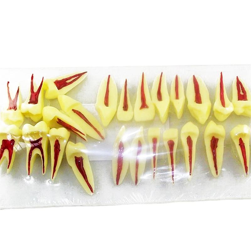 20pcs Two Times Pediatric Cross-Sectioned Loose Teeth Anatomical Model with Nerve Pulp Cavity