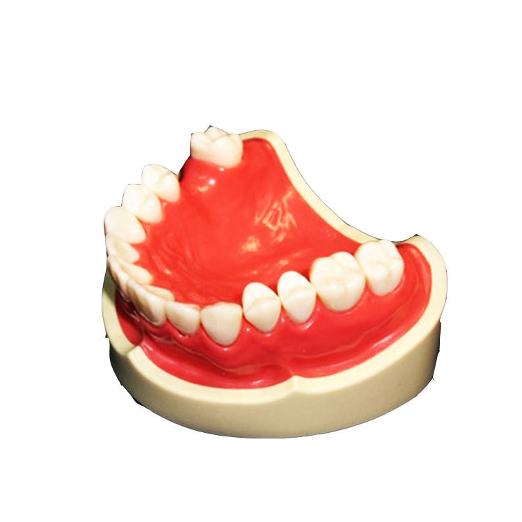 21pcs Teeth Missing Dental Model for Students Practice