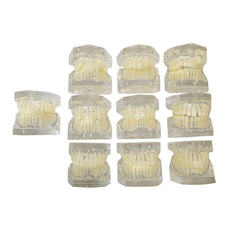 Transparent Ortho Classification Dental Teaching Orthodontic Model Set
