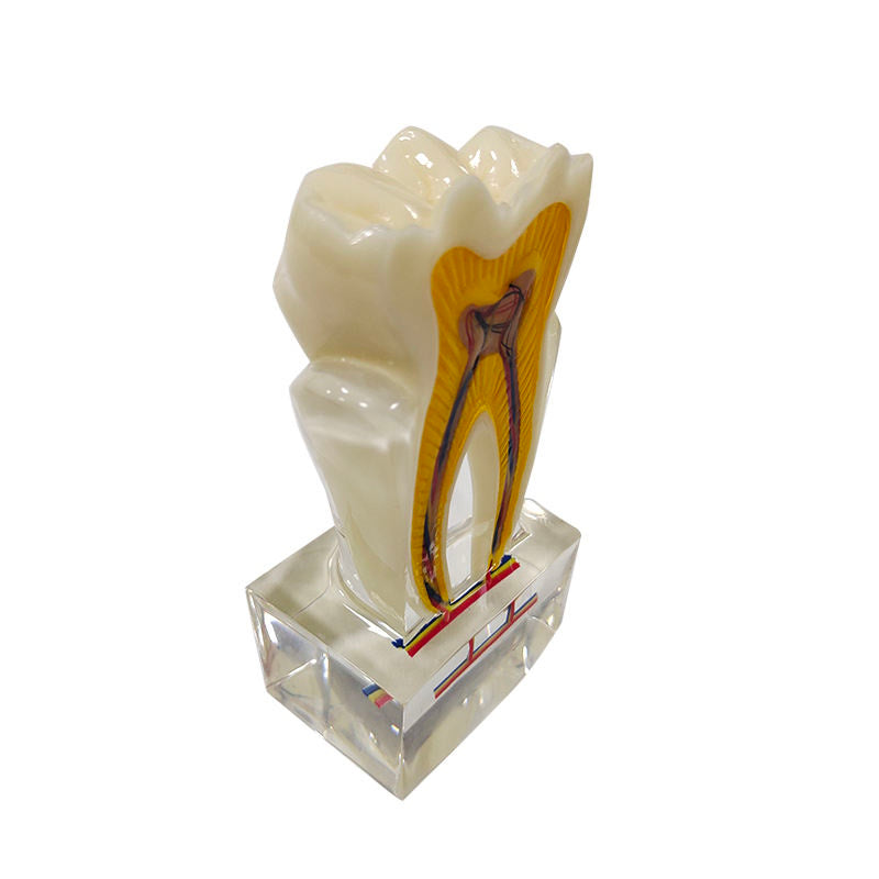 Sectioned 6 Times Molar Dental Tooth Model with Nerve