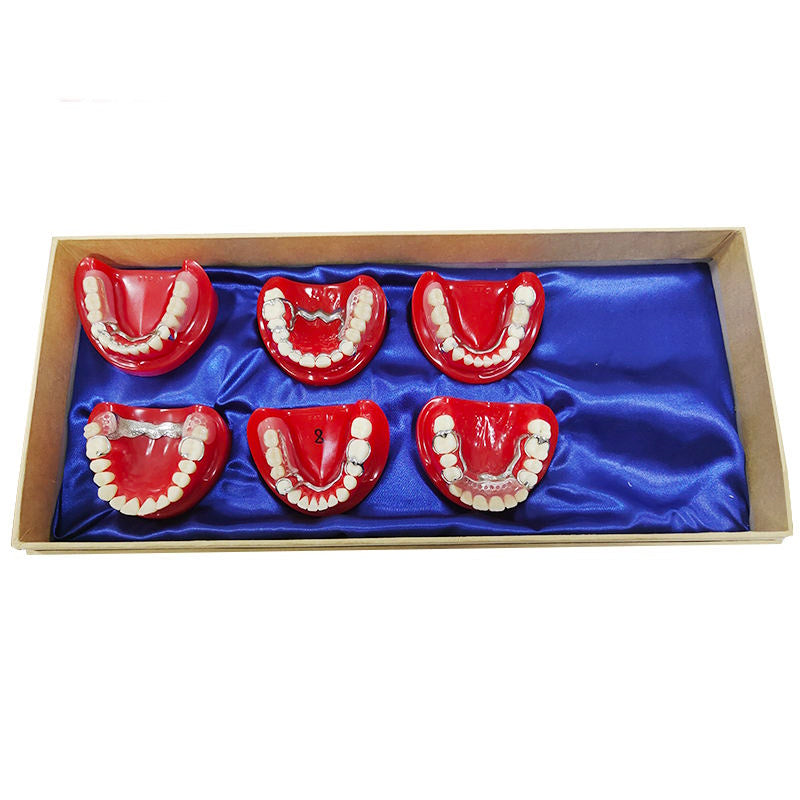 Import Quartz Rubber Plate Partially Edentulous Model for Guiding Students to Complete the Preparation