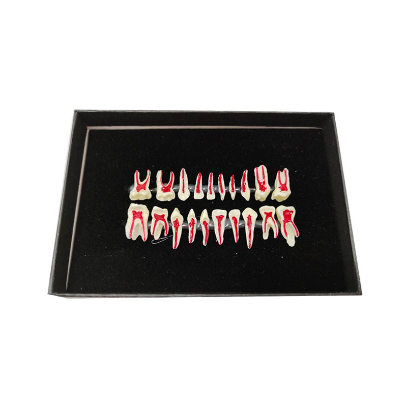 20pcs Two Times Pediatric Cross-Sectioned Loose Teeth Anatomical Model with Nerve Pulp Cavity