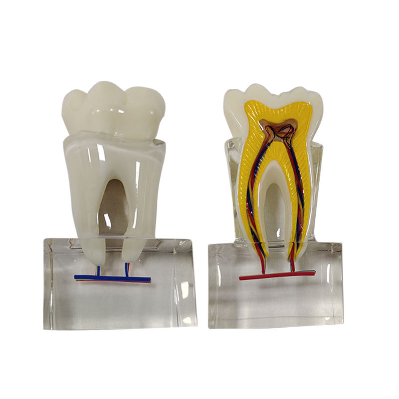 Sectioned 6 Times Molar Dental Tooth Model with Nerve